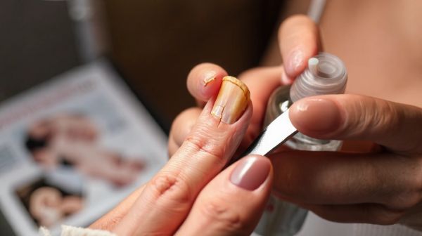 Top conseils pour revitaliser des ongles abîmés avec succès